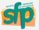 SFP