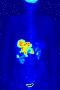 imagerie TEP