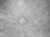 Pleine Lune - 27.12.2004 - Canon A70 - 400 ISO, f/d 8 - Zoom Tycho Brahe   (961 Ko)