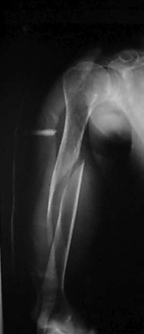 [ Radiographie 1-02 X-Ray ]